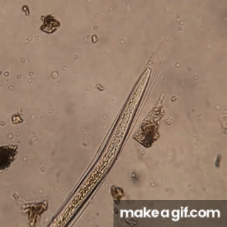 Partie III: Maladies dues aux nématodes